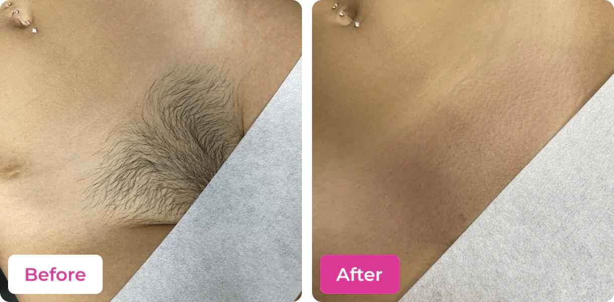 Painless Effective Meow Body Hair Removal Wax Powder..