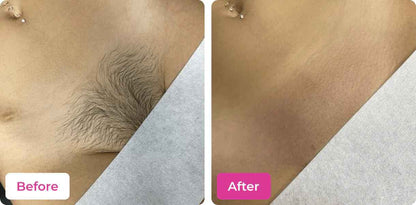 Painless Effective Meow Body Hair Removal Wax Powder..